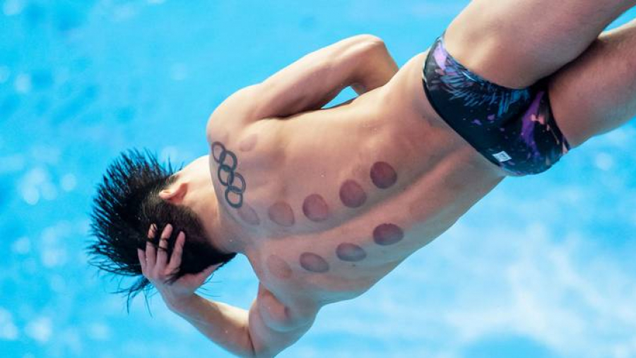 أولمبياد طوكيو: استخدام الرياضيين للحجامة يلفت الأنظار (صور)